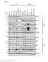Fig. 17 - Compositions and methods for treating primary effusion lymphoma