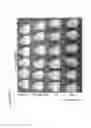 Fig. 44 - Compositions and methods for treating primary effusion lymphoma
