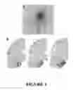 Fig. 02 - Method for Preventing and/or Treating Chronic Traumatic Encephalopathy - III