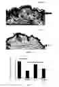 Fig. 02 - Pharmaceutical compositions for preventing glucocorticoid-induced skin thinning