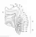 Fig. 01 - DIRECT MEDICAMENT PERIODONTAL DELIVERY METHOD AND ASSEMBLY FOR REDUCTION OF THE SYSTEMIC INFLAMMATORY MARKERS