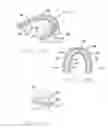 Fig. 03 - DIRECT MEDICAMENT PERIODONTAL DELIVERY METHOD AND ASSEMBLY FOR REDUCTION OF THE SYSTEMIC INFLAMMATORY MARKERS