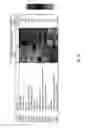 Fig. 04 - Methods for treating and preventing prostate cancer bone metastases