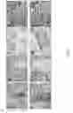 Fig. 13 - Methods for treating and preventing prostate cancer bone metastases