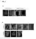 Fig. 02 - SOMATIC STEM CELLS FOR TREATING BONE DEFECTS