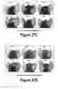 Fig. 16 - Molecular and Herbal Combinations for Treating Psoriasis