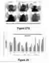 Fig. 18 - Molecular and Herbal Combinations for Treating Psoriasis