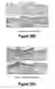 Fig. 20 - Molecular and Herbal Combinations for Treating Psoriasis
