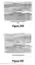 Fig. 21 - Molecular and Herbal Combinations for Treating Psoriasis