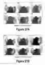 Fig. 15 - Molecular and Herbal Combinations for Treating Psoriasis