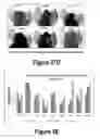 Fig. 18 - Molecular and Herbal Combinations for Treating Psoriasis