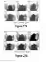 Fig. 15 - Molecular and Herbal Combinations for Treating Psoriasis