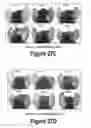 Fig. 16 - Molecular and Herbal Combinations for Treating Psoriasis