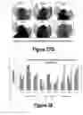 Fig. 18 - Molecular and Herbal Combinations for Treating Psoriasis