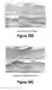 Fig. 20 - Molecular and Herbal Combinations for Treating Psoriasis