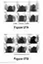 Fig. 15 - Molecular and herbal combinations for treating psoriasis