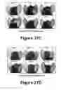 Fig. 16 - Molecular and herbal combinations for treating psoriasis