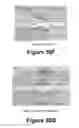 Fig. 22 - Molecular and herbal combinations for treating psoriasis