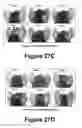 Fig. 16 - Molecular and herbal combinations for treating psoriasis