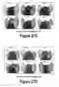 Fig. 16 - Molecular and Herbal Combinations for Treating Psoriasis