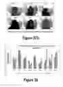 Fig. 18 - Molecular and Herbal Combinations for Treating Psoriasis
