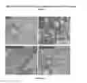 Fig. 22 - Compositions and methods for preventing or treating diseases, conditions, or processes characterized by aberrant fibroblast proliferation and extracellular matrix deposition