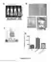 Fig. 11 - NGAL AND URINARY TRACT INFECTION