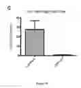 Fig. 14 - NGAL AND URINARY TRACT INFECTION