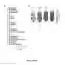 Fig. 18 - NGAL AND URINARY TRACT INFECTION