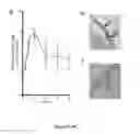 Fig. 19 - NGAL AND URINARY TRACT INFECTION