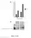 Fig. 35 - NGAL AND URINARY TRACT INFECTION