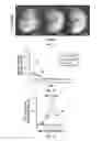 Fig. 02 - Compositions and methods relating to myomaker-induced muscle cell fusion