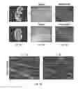 Fig. 04 - Compositions and methods relating to myomaker-induced muscle cell fusion