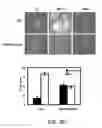 Fig. 12 - Methods and materials for treating cancers that express reduced levels of wild-type p53 polypeptides