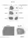 Fig. 23 - Photoactivatable lipid-based nanoparticles as vehicles for dual agent delivery