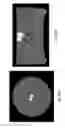 Fig. 22 - Cobalt-based MRI contrast agent and imaging system