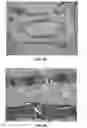 Fig. 03 - Systems, compositions, and methods for local imaging and treatment of pain