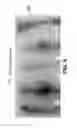 Fig. 07 - Systems, compositions, and methods for local imaging and treatment of pain