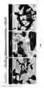 Fig. 06 - Moldable bone graft compositions