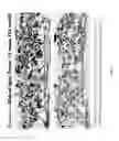 Fig. 07 - Moldable bone graft compositions