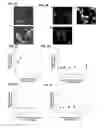 Fig. 03 - 3D tissue-engineered bone marrow for personalized therapy and drug development