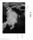 Fig. 07 - Shaped bone graft materials and methods of use