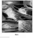 Fig. 04 - Three-Dimensional Scaffold Functionalized with Micro-Tissues for Tissue Regeneration