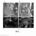 Fig. 06 - Three-Dimensional Scaffold Functionalized with Micro-Tissues for Tissue Regeneration