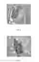 Fig. 06 - Use of dextran sulfate