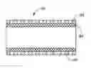Fig. 01 - STENTS MODIFIED WITH MATERIAL COMPRISING AMNION TISSUE AND CORRESPONDING PROCESSES