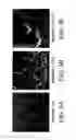 Fig. 05 - Process for the production of storable implants with an ultrahydrophilic surface