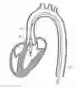 Fig. 01 - Catheter device