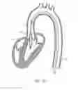 Fig. 26 - Catheter device