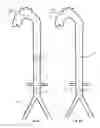 Fig. 17 - Intra-aortic balloon apparatus, assist devices and methods for improving flow, counterpulsation and haemodynamics